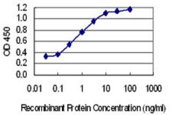 FBXO41, Mouse anti-Human, Clone: 6B6, Abnova 100&mu;g; Unconjugated:Antibodies,