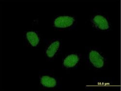 REM2, Mouse anti-Human, Polyclonal Antibody, Abnova 50&mu;g; Unconjugated:Antibodies,