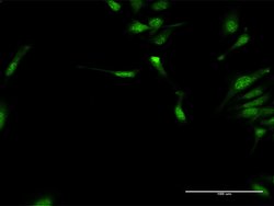 DYX1C1, Rabbit anti-Human, Polyclonal Antibody, Abnova 100&mu;g; Unconjugated:Antibodies,