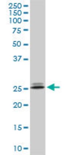 PHOSPHO1, Mouse anti-Human, Clone: 1A11, Abnova 50&mu;g; Unconjugated:Antibodies,