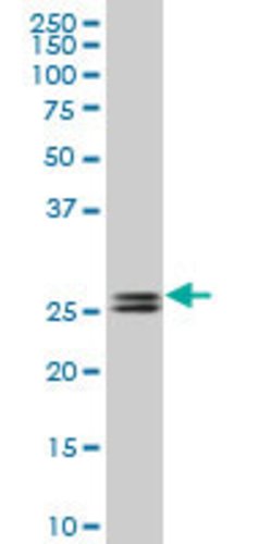 PHOSPHO1, Mouse anti-Human, Clone: 1A11, Abnova 50&mu;g; Unconjugated:Antibodies,