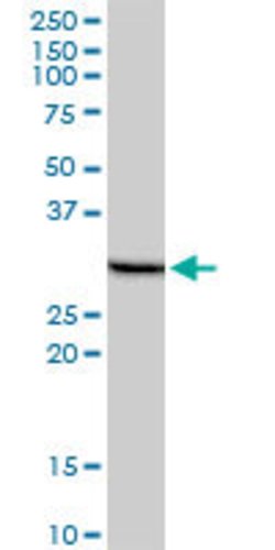 PHOSPHO1, Mouse anti-Human, Clone: 1A11, Abnova 50&mu;g; Unconjugated:Antibodies,