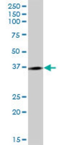 LOC170082, Mouse anti-Human, Polyclonal Antibody, Abnova 50 &mu;g | Buy Online | Abnova | Fisher Scientific