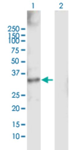 SDR16C5, Rabbit anti-Human, Polyclonal Antibody, Abnova 100&mu;L; Unconjugated:Antibodies,