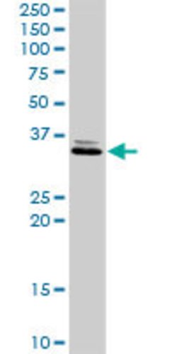 SDR16C5, Rabbit anti-Human, Polyclonal Antibody, Abnova 100&mu;L; Unconjugated:Antibodies,