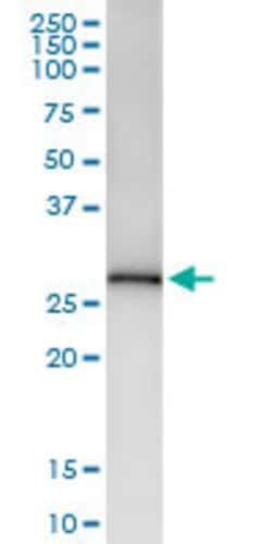 SDR16C5, Rabbit anti-Human, Polyclonal Antibody, Abnova 100&mu;L; Unconjugated:Antibodies,