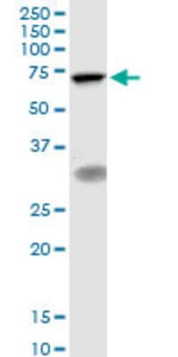 TIGD1, Mouse anti-Human, Polyclonal Antibody, Abnova 50&mu;g; Unconjugated:Anticuerpos