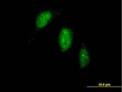 TIGD1, Mouse anti-Human, Polyclonal Antibody, Abnova 50&mu;g; Unconjugated:Anticuerpos