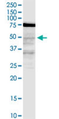 LASS3, Mouse anti-Human, Clone: 6C12, Abnova 100 &mu;g | Buy Online | Abnova | Fisher Scientific