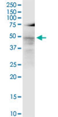 LASS3, Mouse anti-Human, Clone: 6C12, Abnova 100 &mu;g | Buy Online | Abnova | Fisher Scientific