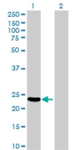 N6AMT2, Mouse anti-Human, Polyclonal Antibody, Abnova 50&mu;L; Unconjugated:Antibodies,