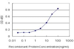 NEIL2, Mouse anti-Human, Clone: 1B7, Abnova&trade;