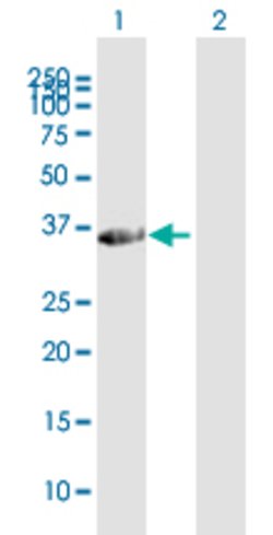 FAM21C, Mouse anti-Human, Polyclonal Antibody, Abnova 50 &mu;L | Buy Online | Abnova | Fisher Scientific
