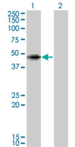ANGPTL5, Mouse anti-Human, Clone: 1B2, Abnova 50&mu;g; Unconjugated:Antibodies,