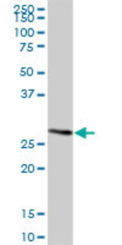 C12orf72, Mouse anti-Human, Polyclonal Antibody, Abnova 50&mu;g; Unconjugated:Antibodies,