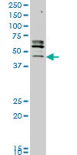STK32C, Mouse anti-Human, Clone: 3E8, Abnova 100 &mu;g | Buy Online | Abnova | Fisher Scientific