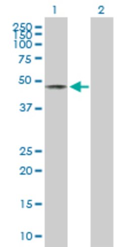 C3orf64, Mouse anti-Human, Polyclonal Antibody, Abnova 50 &mu;g | Buy Online | Abnova | Fisher Scientific
