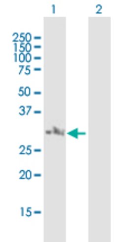 NSMCE2, Mouse anti-Human, Polyclonal Antibody, Abnova 50 &mu;L | Buy Online | Abnova | Fisher Scientific