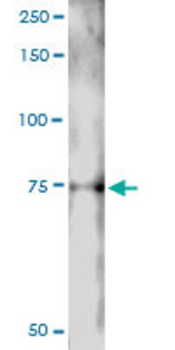 LIN9, Rabbit anti-Human, Polyclonal Antibody, Abnova 100&mu;L; Unconjugated:Antibodies,