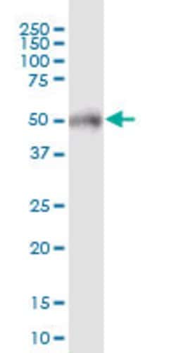 POTEA, Mouse anti-Human, Polyclonal Antibody, Abnova 50&mu;g; Unconjugated:Antibodies,