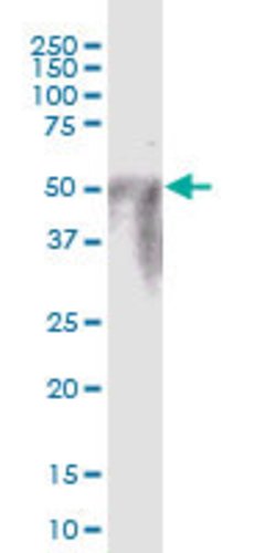 POTEA, Mouse anti-Human, Polyclonal Antibody, Abnova 50&mu;g; Unconjugated:Antibodies,