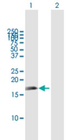 APITD1, Mouse anti-Human, Polyclonal Antibody, Abnova 50&mu;g; Unconjugated:Antibodies,