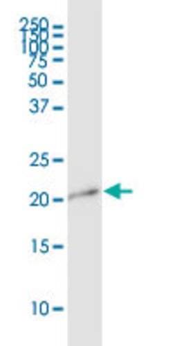 APITD1, Mouse anti-Human, Polyclonal Antibody, Abnova 50&mu;g; Unconjugated:Antibodies,