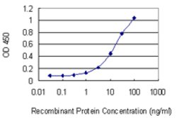 NHLRC1, Mouse anti-Human, Clone: 3G6, Abnova 100 &mu;g | Buy Online | Abnova | Fisher Scientific