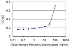 RNF148, Mouse anti-Human, Clone: 2D3, Abnova 100&mu;g; Unconjugated:Antibodies,