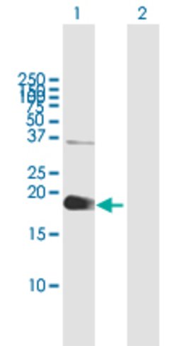 ZCCHC13, Mouse anti-Human, Polyclonal Antibody, Abnova 50&mu;g; Unconjugated:Antibodies,