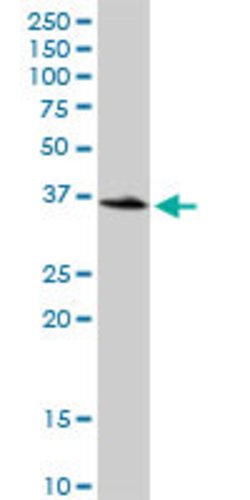 LOC541473, Rabbit anti-Human, Polyclonal Antibody, Abnova 100&mu;g; Unconjugated:Antibodies,