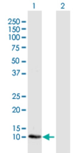 LOC541473, Rabbit anti-Human, Polyclonal Antibody, Abnova 100&mu;g; Unconjugated:Antibodies,