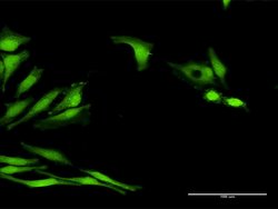 LOC541473, Rabbit anti-Human, Polyclonal Antibody, Abnova 100&mu;g; Unconjugated:Antibodies,