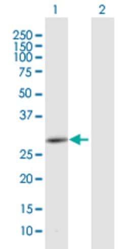 CEMP1, Mouse anti-Human, Polyclonal Antibody, Abnova 50 &mu;g | Buy Online | Abnova | Fisher Scientific
