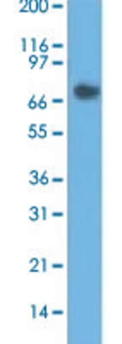CEACAM5, Mouse anti-Human, Clone: COL-1, Abnova 100&mu;g; Unconjugated:Antibodies,