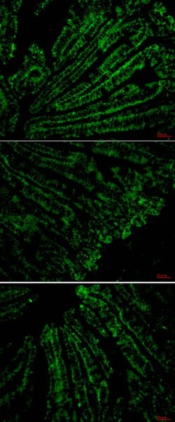 CD4, Mouse anti-Human, Clone: 11A1, Abnova 100 &mu;L | Buy Online | Abnova | Fisher Scientific