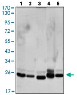 CBX1, Mouse anti-Human, Clone: 5A3, Abnova 100&mu;L; Unconjugated:Antibodies,