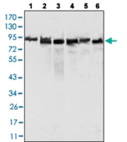 MLH1, Mouse anti-Human, Clone: 4C9C7, Abnova 100&mu;L; Unconjugated:Antibodies,