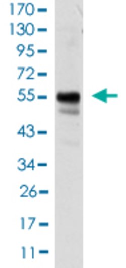 RUNX1, Mouse anti-Human, Clone: 5A1, Abnova 100 &mu;L | Buy Online | Abnova | Fisher Scientific
