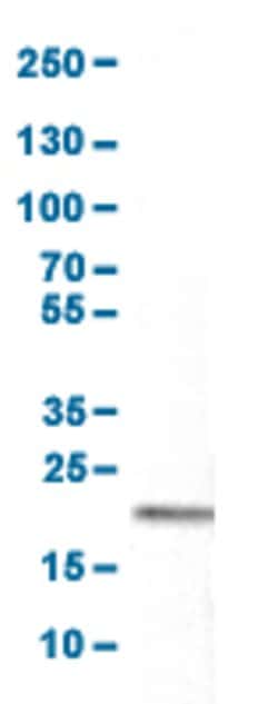 CD3E, Mouse anti-Human, Clone: CL1497, Abnova 100&mu;L; Unconjugated:Antibodies,