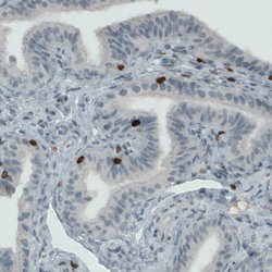 CD3E, Mouse anti-Human, Clone: CL1497, Abnova 100&mu;L; Unconjugated:Antibodies,