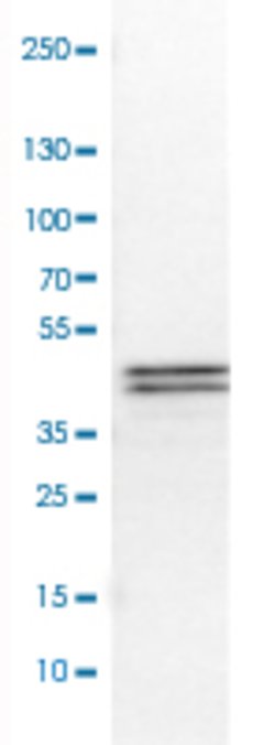 APOL1, Mouse anti-Human, Clone: CL0173, Abnova 100 &mu;L | Buy Online | Abnova | Fisher Scientific