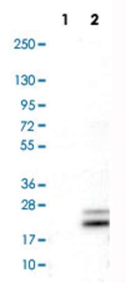 RNASE7, Mouse anti-Human, Clone: CL0224, Abnova 100 &mu;L | Buy Online | Abnova | Fisher Scientific