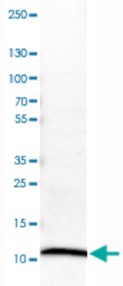 S100A4, Mouse anti-Human, Clone: CL0240, Abnova 100&mu;L; Unconjugated:Antibodies,