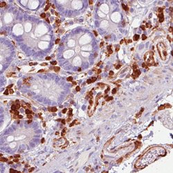 S100A4, Mouse anti-Human, Clone: CL0240, Abnova 100&mu;L; Unconjugated:Antibodies,