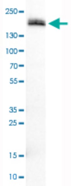 PODXL, Mouse anti-Human, Clone: CL0284, Abnova 100&mu;L; Unconjugated:Antibodies,