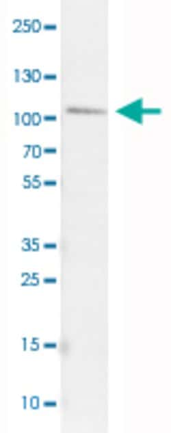 SATB2, Mouse anti-Human, Clone: CL0319, Abnova 100&mu;L; Unconjugated:Antibodies,