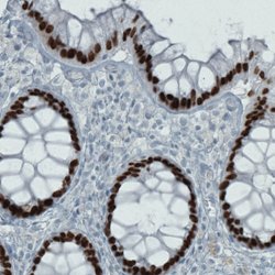 SATB2, Mouse anti-Human, Clone: CL0319, Abnova 100&mu;L; Unconjugated:Antibodies,