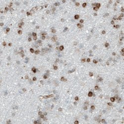 MTDH, Mouse anti-Human, Clone: CL0401, Abnova 100&mu;L; Unconjugated:Antibodies,