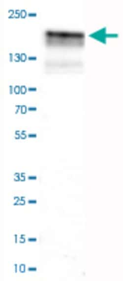 EGFR, Mouse anti-Human, Clone: CL0815, Abnova 100&mu;L; Unconjugated:Antibodies,